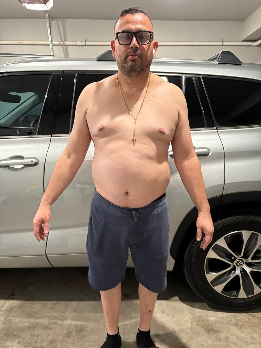 Foto de Ramón al inicio de su proceso